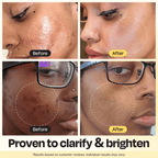 Vitamin C Clay Mask